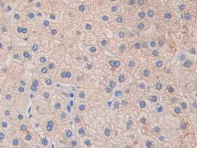 Immunohistochemistry (Formalin/PFA-fixed paraffin-embedded sections) - Anti-Glycine decarboxylase antibody (AB232989)