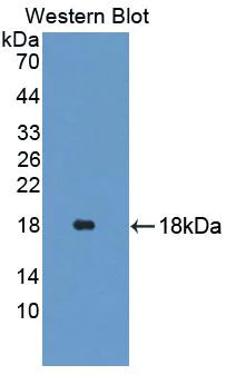 Western blot - Anti-Glycine decarboxylase antibody (AB232989)