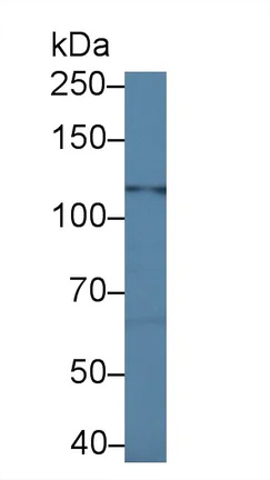 Western blot - Anti-Glycine decarboxylase antibody (AB232989)