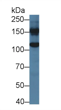 Western blot - Anti-Glycine decarboxylase antibody (AB232989)