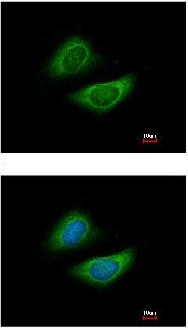 Immunocytochemistry/ Immunofluorescence - Anti-Glycine decarboxylase antibody (AB97625), expandable thumbnail