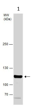 Western blot - Anti-Glycine decarboxylase antibody (AB97625)