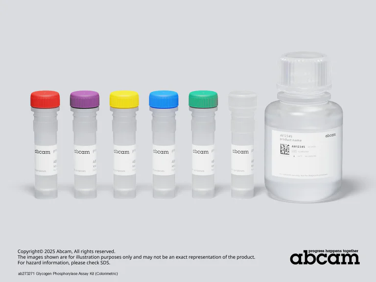 Schematic Diagram - Glycogen Phosphorylase Assay Kit (Colorimetric) (AB273271)