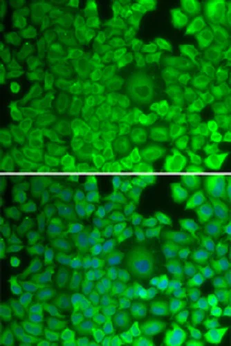 Immunocytochemistry/ Immunofluorescence - Anti-Glycogen synthase 1/GYS1 antibody (AB230422)