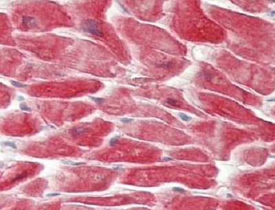 Immunohistochemistry (Formalin/PFA-fixed paraffin-embedded sections) - Anti-Glycogen synthase 1/GYS1 antibody (AB230422)