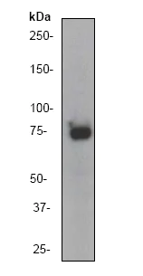 Western blot - Anti-Glycogen synthase 1/GYS1 antibody [EP817Y] (AB40810)