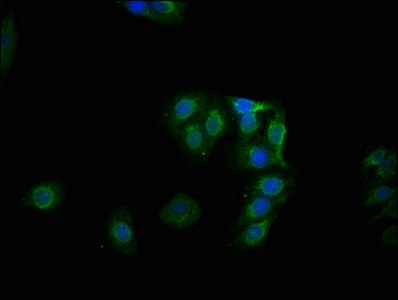 Immunocytochemistry/ Immunofluorescence - Anti-Glycogen synthase 1/GYS1 (phospho S641) antibody [1D1] (AB314028), expandable thumbnail