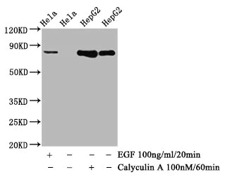 Western blot - Anti-Glycogen synthase 1/GYS1 (phospho S641) antibody [1D1] (AB314028)