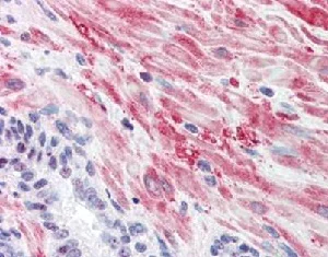 Immunohistochemistry (Formalin/PFA-fixed paraffin-embedded sections) - Anti-Glycogen synthase 1/GYS1 (phospho S641) antibody (AB2479)