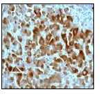 Immunohistochemistry (Formalin/PFA-fixed paraffin-embedded sections) - Anti-Glycogen synthase 1/GYS1 (phospho S641) antibody [EP852Y] - BSA and Azide free (AB247514)