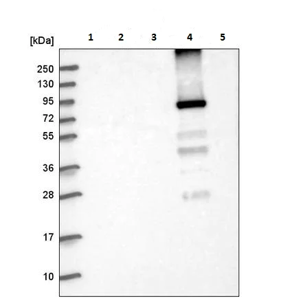 Western blot - Anti-Glycogen synthase 2 antibody - C-terminal (AB224552)