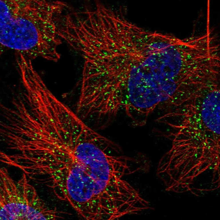 Immunocytochemistry/ Immunofluorescence - Anti-Glycogenin 1 antibody (AB272606)