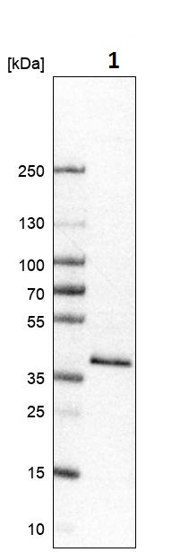 Western blot - Anti-Glycogenin 1 antibody (AB272606), expandable thumbnail