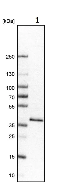 Western blot - Anti-Glycogenin 1 antibody (AB272606)