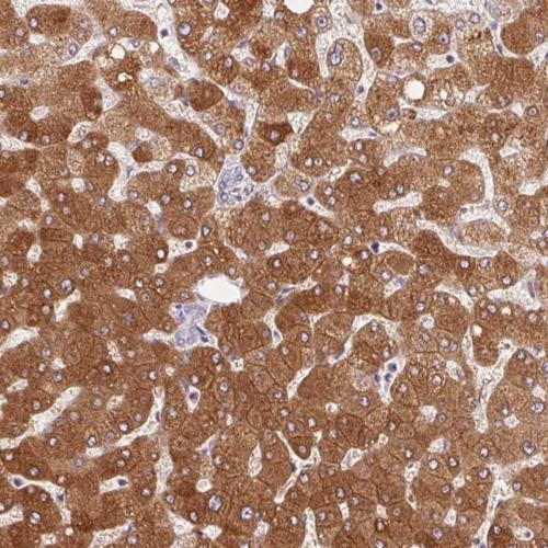 Immunohistochemistry (Formalin/PFA-fixed paraffin-embedded sections) - Anti-Glycogenin 2 antibody (AB204784)
