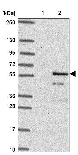 Western blot - Anti-Glycogenin 2 antibody (AB204784)