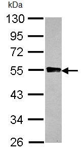 Western blot - Anti-Glycogenin 2 antibody (AB96359), expandable thumbnail