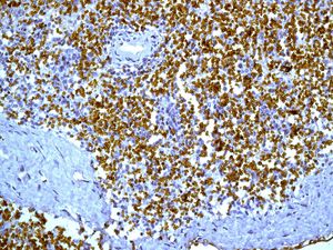 Immunohistochemistry (Formalin/PFA-fixed paraffin-embedded sections) - Anti-Glycophorin A antibody [EPR8199] - BSA and Azide free (AB226153), expandable thumbnail