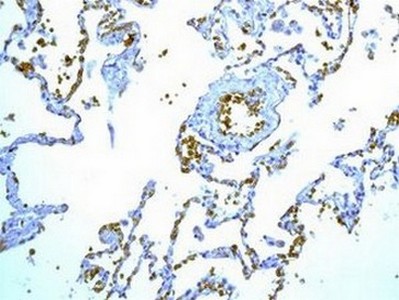 Immunohistochemistry (Formalin/PFA-fixed paraffin-embedded sections) - Anti-Glycophorin A antibody [EPR8199] - BSA and Azide free (AB226153), expandable thumbnail