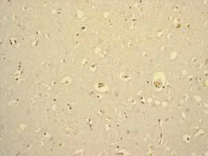 Immunohistochemistry (Formalin/PFA-fixed paraffin-embedded sections) - Anti-Glycophorin A antibody [EPR8200] (AB129024)