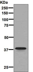 Western blot - Anti-Glycophorin A antibody [EPR8200] (AB129024), expandable thumbnail