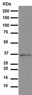 Western blot - Anti-Glycophorin A antibody [EPR8200] (AB129024), expandable thumbnail