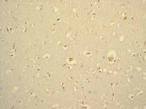 Immunohistochemistry (Formalin/PFA-fixed paraffin-embedded sections) - Anti-Glycophorin A antibody [EPR8200] - BSA and Azide free (ab218372), expandable thumbnail