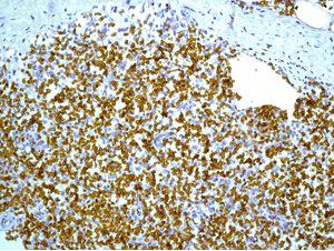 Immunohistochemistry (Formalin/PFA-fixed paraffin-embedded sections) - Anti-Glycophorin A antibody [EPR8200] - BSA and Azide free (AB218372), expandable thumbnail