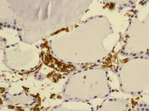 Immunohistochemistry (Formalin/PFA-fixed paraffin-embedded sections) - Anti-Glycophorin A antibody [EPR8200] - BSA and Azide free (AB218372), expandable thumbnail