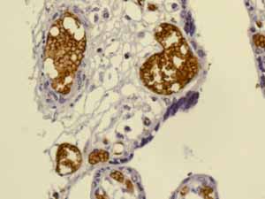 Immunohistochemistry (Formalin/PFA-fixed paraffin-embedded sections) - Anti-Glycophorin A antibody [EPR8200] - BSA and Azide free (ab218372), expandable thumbnail