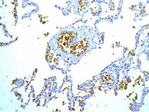 Immunohistochemistry (Formalin/PFA-fixed paraffin-embedded sections) - Anti-Glycophorin A antibody [EPR8200] - BSA and Azide free (AB218372), expandable thumbnail