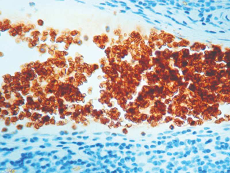 Immunohistochemistry (Formalin/PFA-fixed paraffin-embedded sections) - Anti-Glycophorin A antibody [JC159], prediluted (AB7503), expandable thumbnail