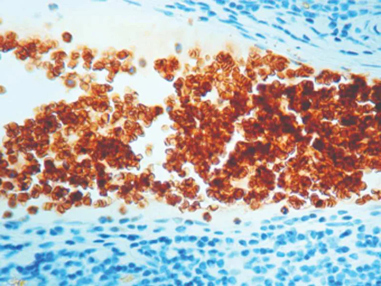 Immunohistochemistry (Formalin/PFA-fixed paraffin-embedded sections) - Anti-Glycophorin A antibody [JC159], prediluted (AB7503)