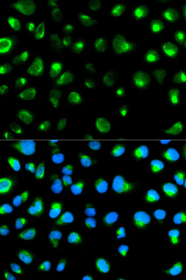 Immunocytochemistry/ Immunofluorescence - Anti-Glycophorin C/GPC antibody (AB175257)