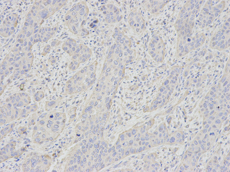 Immunohistochemistry (Formalin/PFA-fixed paraffin-embedded sections) - Anti-Glycophorin C/GPC antibody (AB175257)