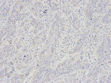 Immunohistochemistry (Formalin/PFA-fixed paraffin-embedded sections) - Anti-Glycophorin C/GPC antibody (AB175257)