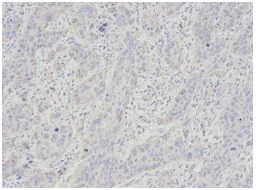 Immunohistochemistry (Formalin/PFA-fixed paraffin-embedded sections) - Anti-Glycophorin C/GPC antibody (AB196568)