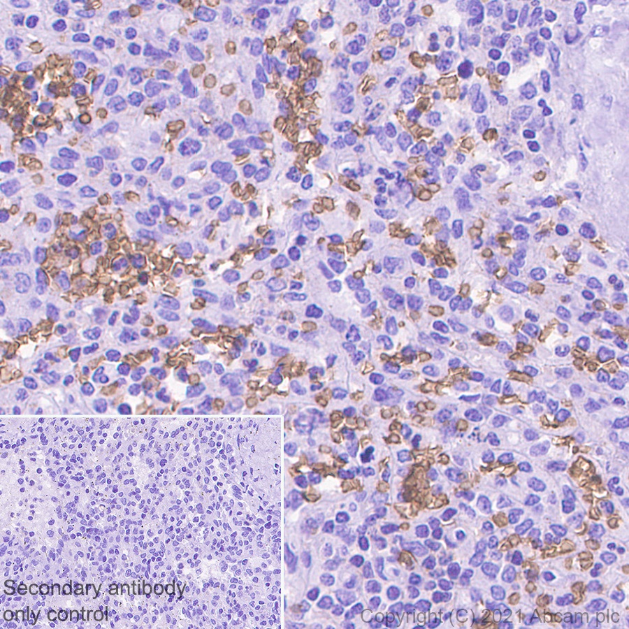 Immunohistochemistry (Formalin/PFA-fixed paraffin-embedded sections) - Anti-Glycophorin C/GPC antibody [EPR4116] - BSA and Azide free (AB247712), expandable thumbnail