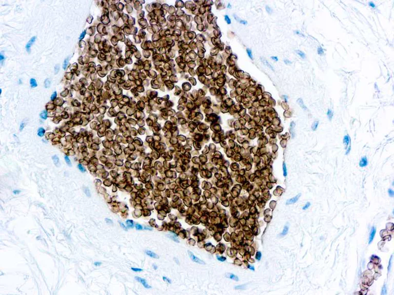 Immunohistochemistry (Formalin/PFA-fixed paraffin-embedded sections) - Anti-Glycophorin C/GPC antibody [Ret40f] (AB9521)