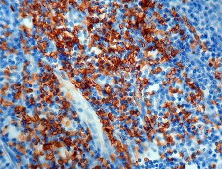 Immunohistochemistry (Formalin/PFA-fixed paraffin-embedded sections) - Anti-Glycophorin C/GPC antibody [Ret40f] (AB9521)