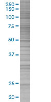 Glycophorin C overexpression 293T lysate (whole cell)