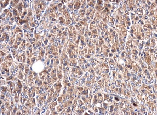Anti-Glypican 1/ GPC1 antibody (ab226855) | Abcam