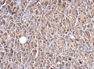 Immunohistochemistry (Formalin/PFA-fixed paraffin-embedded sections) - Anti-Glypican 1/ GPC1 antibody (AB226855)