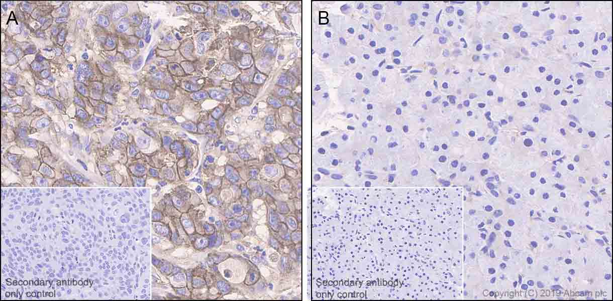 Anti-Glypican 1/ GPC1 antibody [EPR22580-72] (ab255600) | Abcam