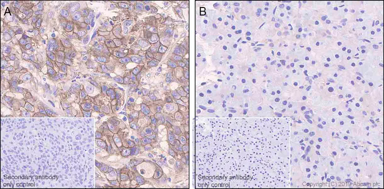 Immunohistochemistry (Formalin/PFA-fixed paraffin-embedded sections) - Anti-Glypican 1/ GPC1 antibody [EPR22580-72] (AB255600)