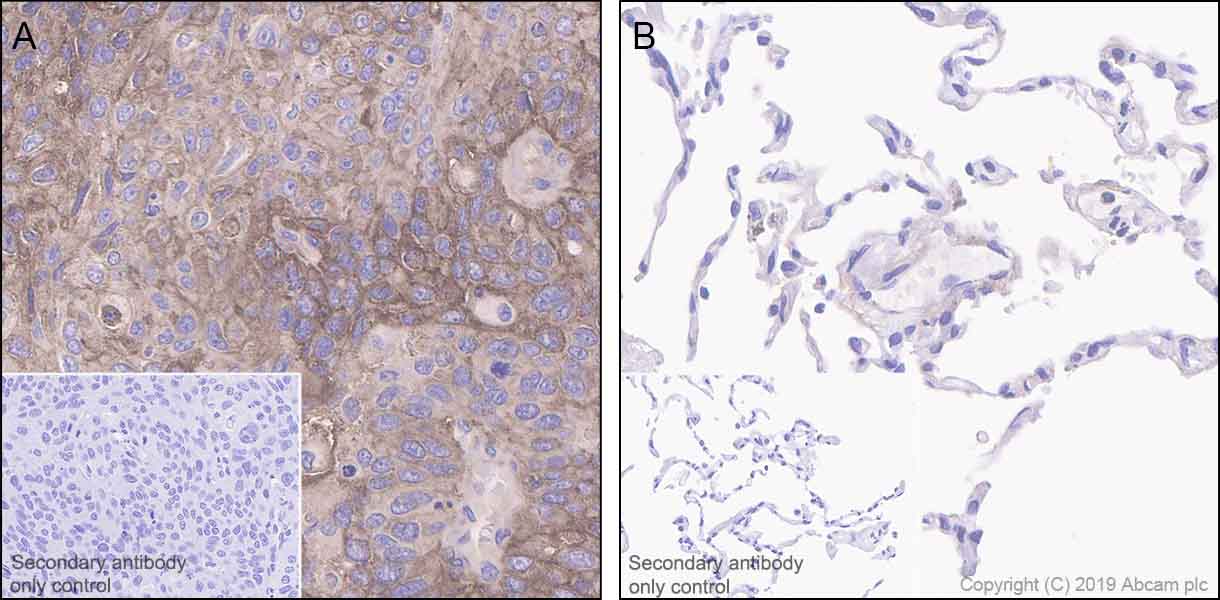 Immunohistochemistry (Formalin/PFA-fixed paraffin-embedded sections) - Anti-Glypican 1/ GPC1 antibody [EPR22580-72] - BSA and Azide free (AB255687), expandable thumbnail