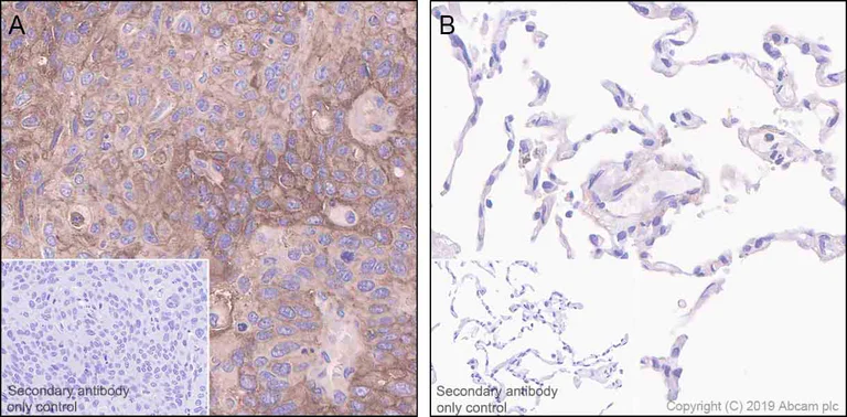 Immunohistochemistry (Formalin/PFA-fixed paraffin-embedded sections) - Anti-Glypican 1/ GPC1 antibody [EPR22580-72] - BSA and Azide free (AB255687)
