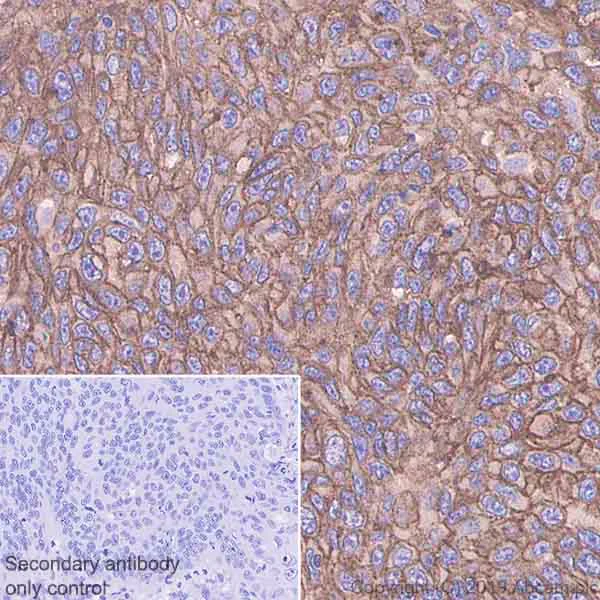 Immunohistochemistry (Formalin/PFA-fixed paraffin-embedded sections) - Anti-Glypican 1/ GPC1 antibody [EPR22580-72] - BSA and Azide free (AB255687)