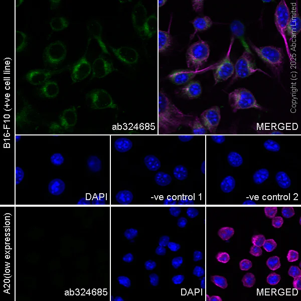Immunocytochemistry/ Immunofluorescence - Anti-Glypican 1/ GPC1 antibody [EPR30349-529] (AB324685)