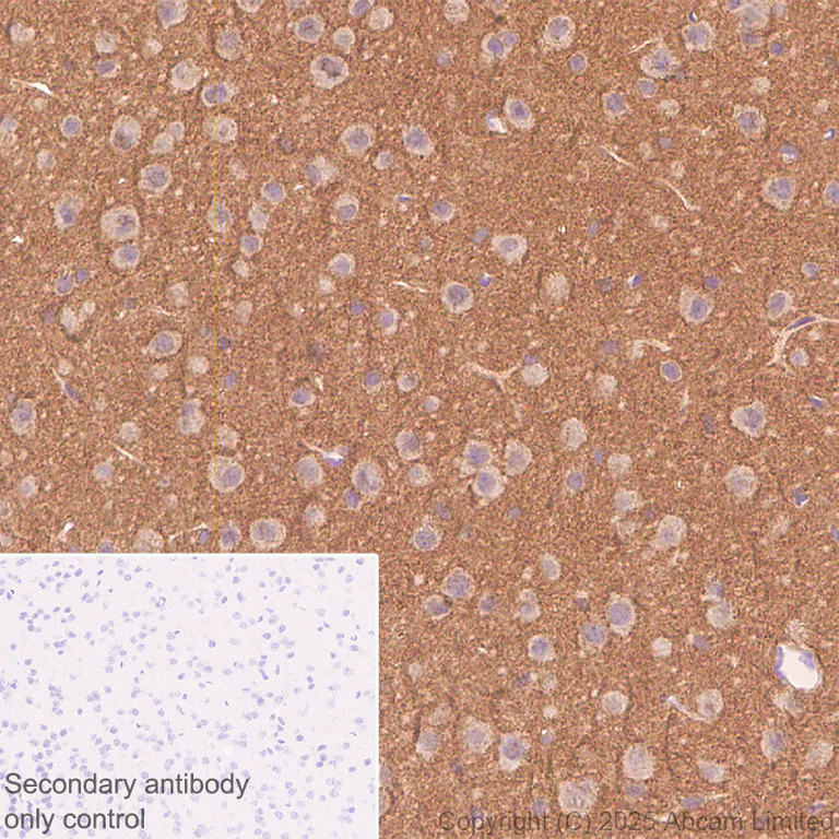 Immunohistochemistry (Formalin/PFA-fixed paraffin-embedded sections) - Anti-Glypican 1/ GPC1 antibody [EPR30349-529] (AB324685)